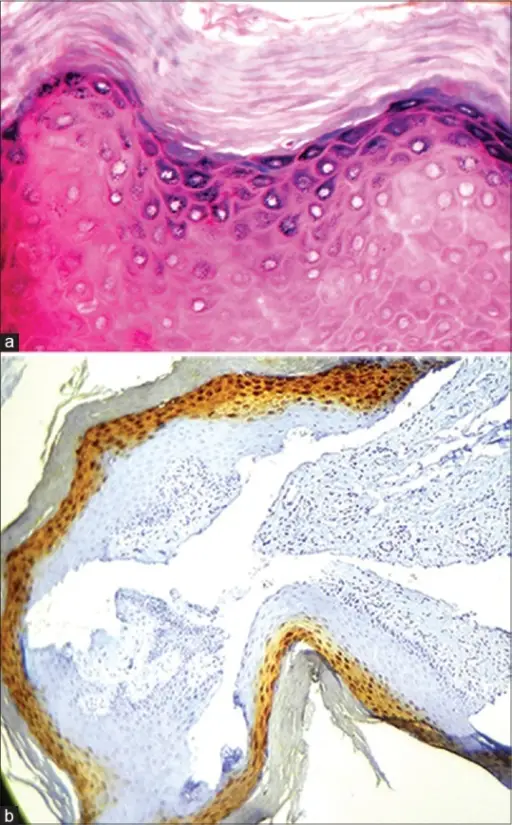 ORAL PATHOLOGY