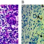 PITUITARY GLAND PATHOLOGY