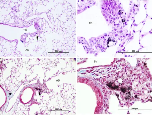 PULMONARY PATHOLOGY