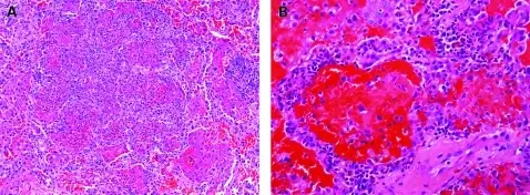 PULMONARY PATHOLOGY