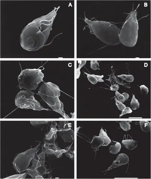 Parasitic Infections