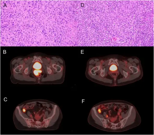 Pathology of the Vagina