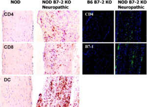 Peripherous Pattern Patterns of Peripheral Neuropathies – Pathosomes