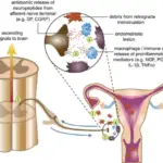 Peritoneal Cavity Inflammatory Disease