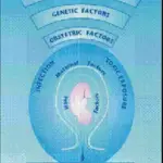 Preterm Premature Rupture of Placental Membranes