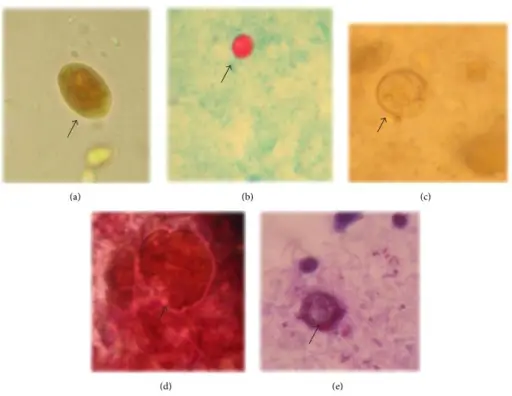 Protozoal Parasitic Infections