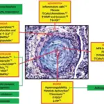 Pulmonary Diseases of Vascular Origin