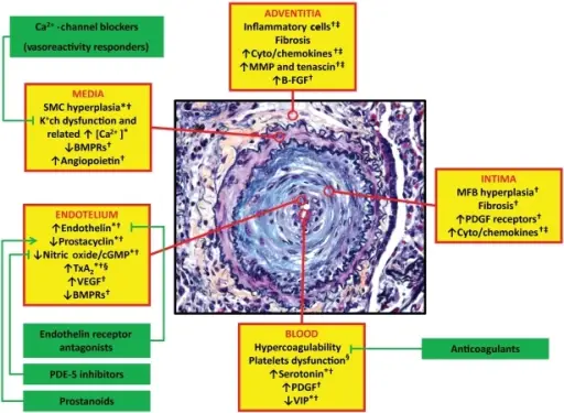 Pulmonary Diseases of Vascular Origin