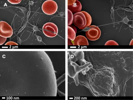 RED BLOOD CELL PATHOLOGY