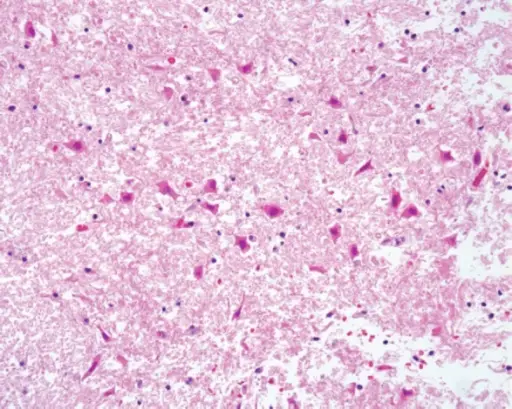 Red Neurons