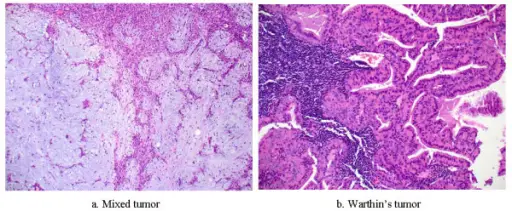 SALIVARY GLAND PATHOLOGY