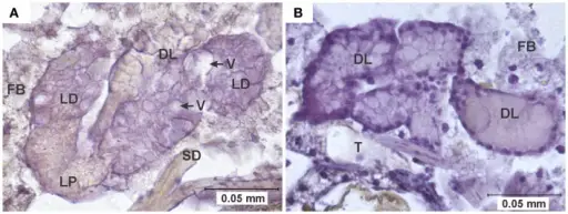 SALIVARY GLAND PATHOLOGY