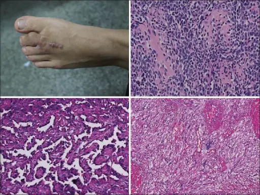 SOFT TISSUE PATHOLOGY