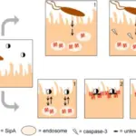 Salmonellosis