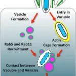 Shigellosis