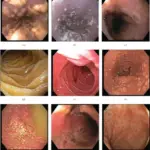 Small Intestine Pathology and Colon Pathology