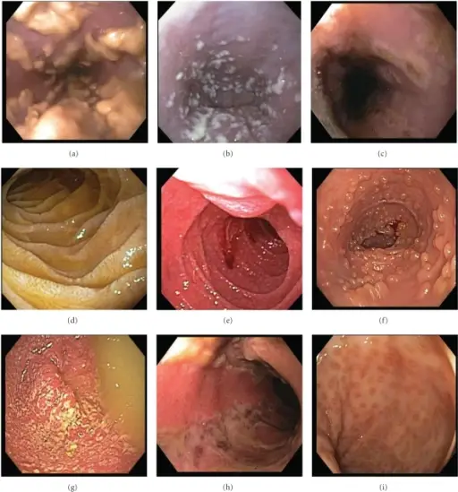 Small Intestine Pathology and Colon Pathology