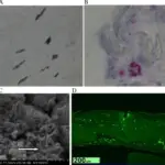 Spirochete Bacterial Infections