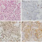 Syndromes Associated with Pituitary Gland Pathology