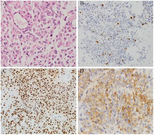 Syndromes Associated with Pituitary Gland Pathology