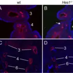 THE DEVELOPMENTAL DISORDERS OF THE THYMUS