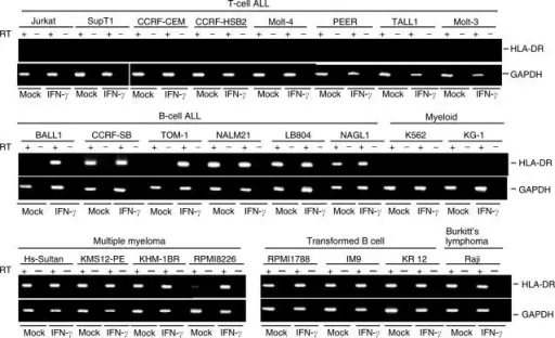 THE POSSIBLE CLASSIFICATIONS OF LYMPHOID OR HEMATOPOIETIC TUMORS