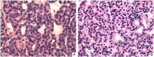 THYROID GLAND PATHOLOGY