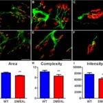 Toxin Mediated Diseases of the Neuromuscular Junction