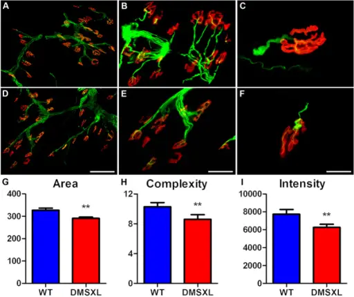 Toxin Mediated Diseases of the Neuromuscular Junction