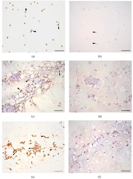 Trichomonas Vaginallis