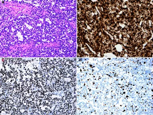 Tumors of Uncertain Origin