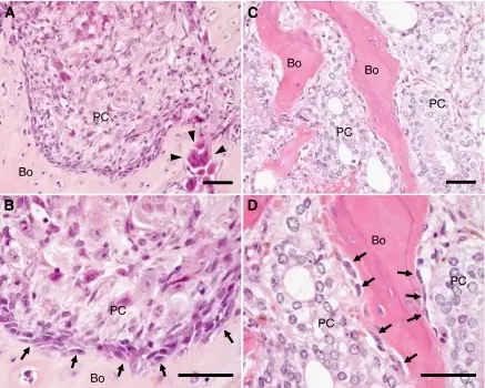 Tumors of the Prostate