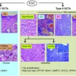 Tumors of the Young