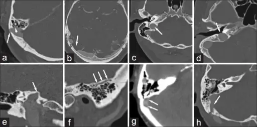 Vascular Anomalies