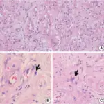 Vascular Disorders of the Testis or Epididymis