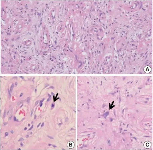 Vascular Disorders of the Testis or Epididymis