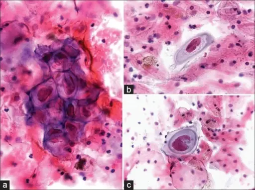 Viral Sexually Transmitted Infections