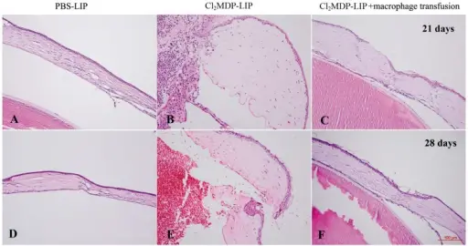 WOUND HEALING