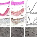 the Vascular Wall Response to Injury