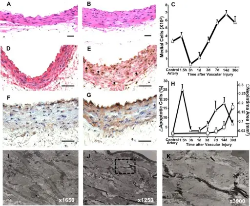 the Vascular Wall Response to Injury