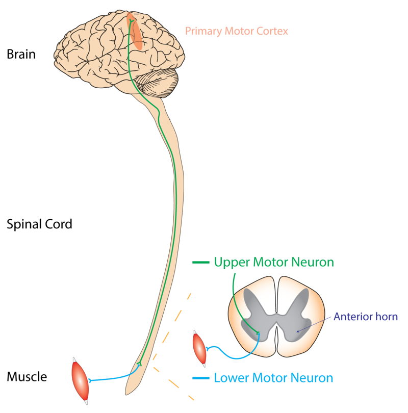 Amytrophic Lateral Sclerosis