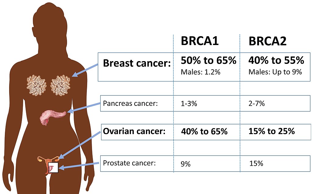 Hereditary Breast Cancer