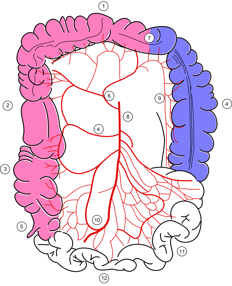 Ischemic Colitis