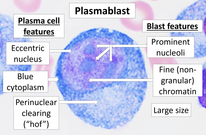 Multiple Myeloma
