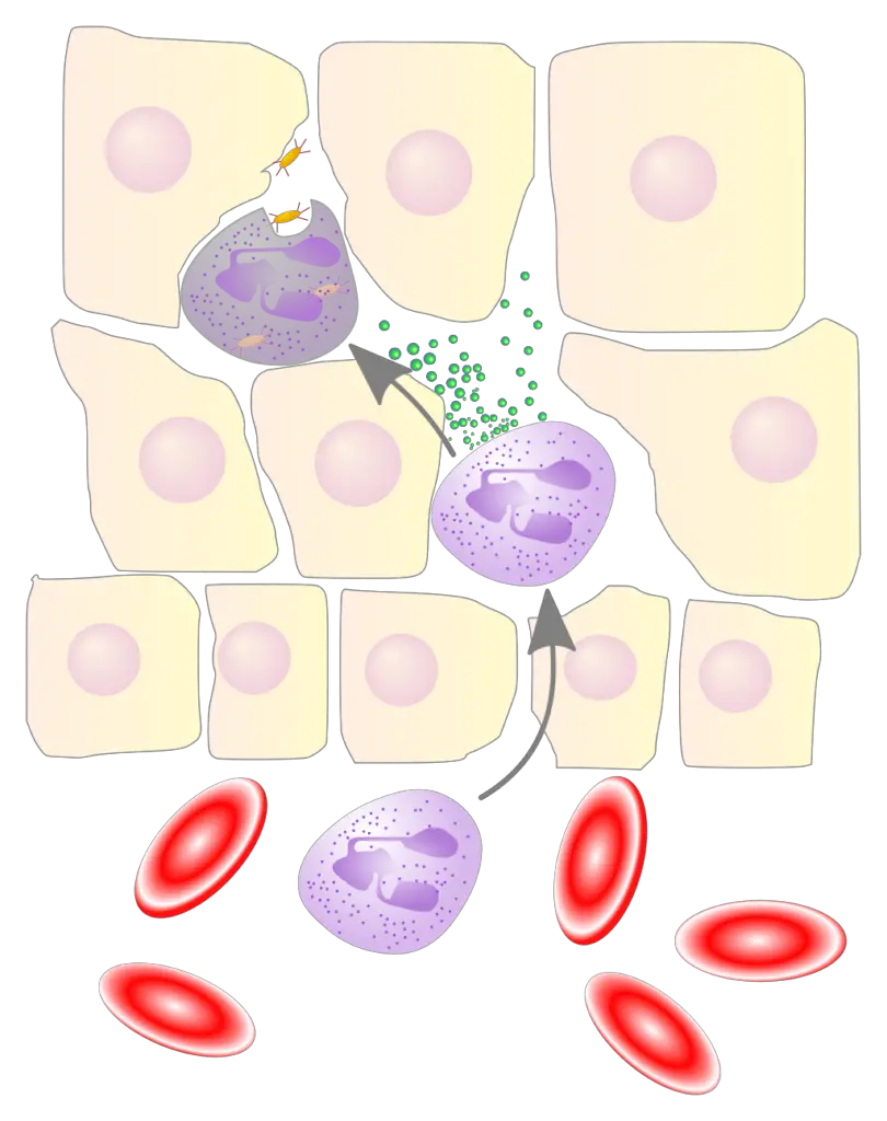 Neutrophils Role In Acute Inflammation