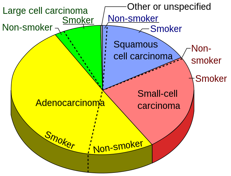 Non-Small Cell Lung Carcinoma