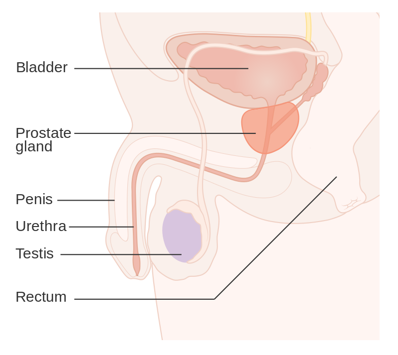 Prostate Adenocarcinoma
