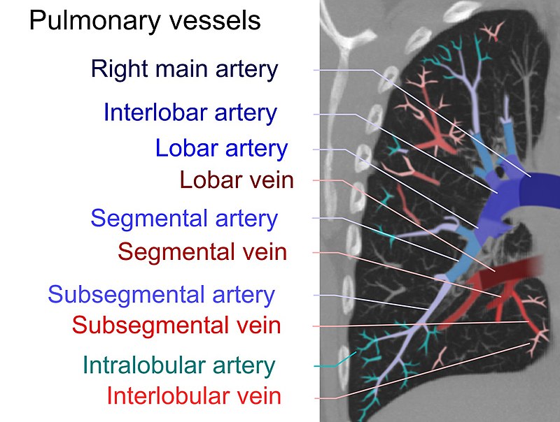 Pulmonary Embolism