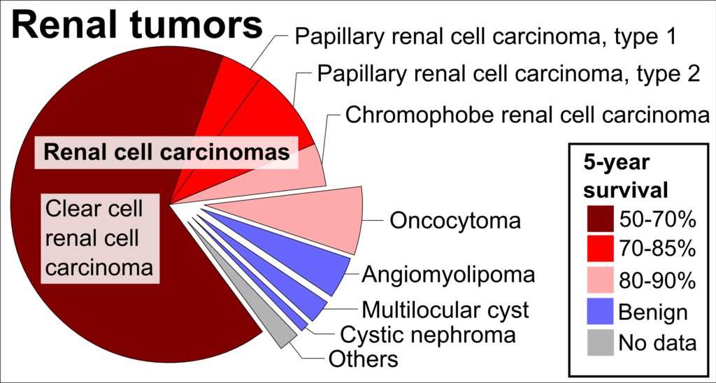 Renal Cell Carcinoma